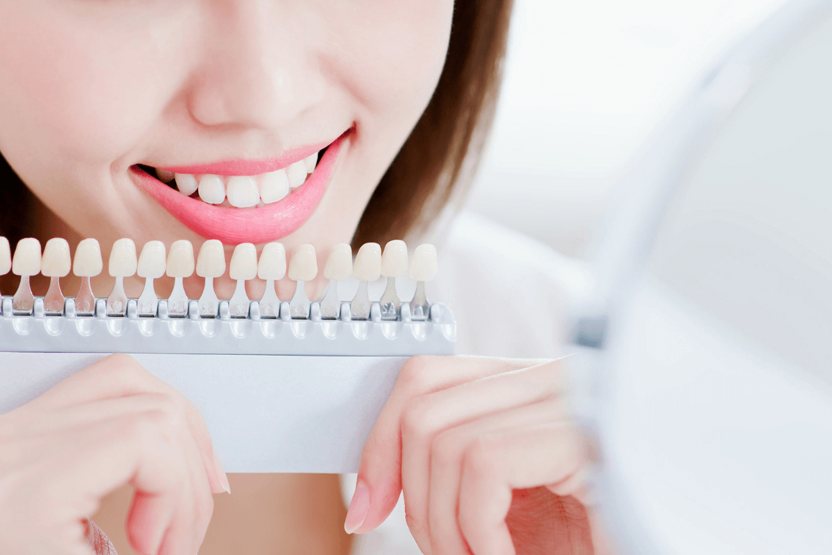 Zahnzusatzversicherung mit Bleaching